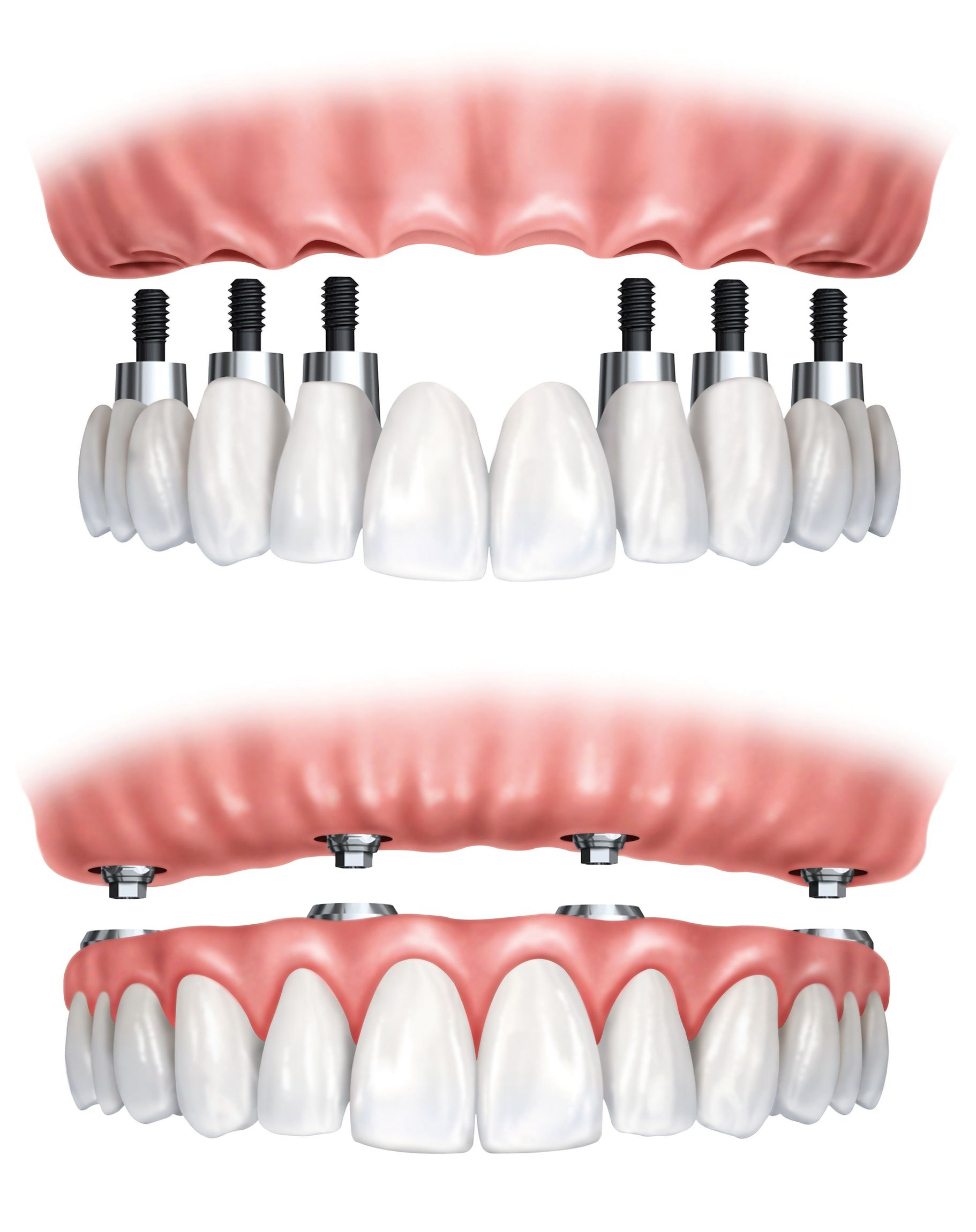 The Importance of Preventative Care Provided by the General Dentists in Childress TX
